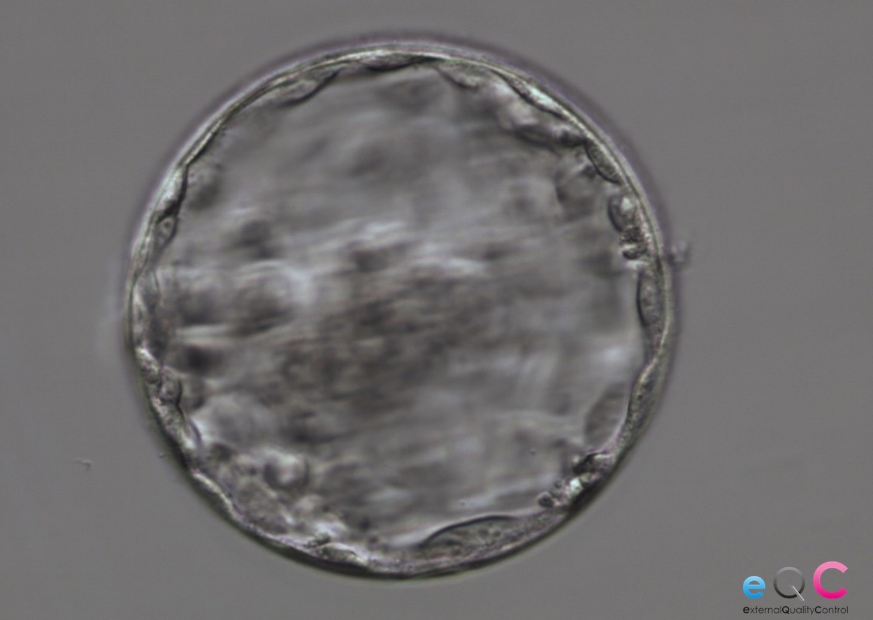     Expanded blastocyst