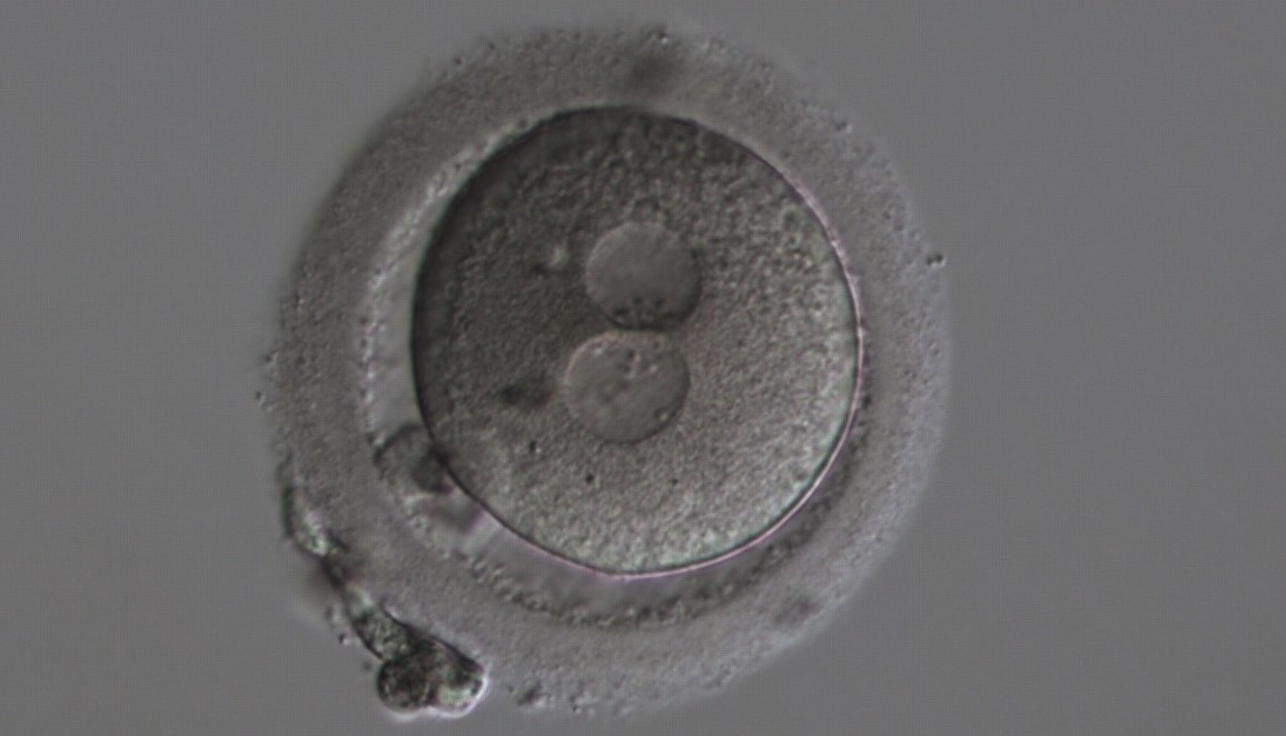     Pronuclear stage (zygote)